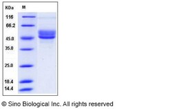 Sino Biological Human SerpinI2 Protein (His Tag) 100ug, Quantity: Each