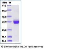 Sino Biological Human ANGPTL2 / Angiopoietin-like 2 Protein (His Tag) 100ug,