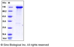 Sino Biological Recombinant Human HK3 Protein (His & GST Tag), Quantity: