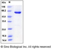 Sino Biological Human CSNK2A2 / CK2A2 Protein (His & GST Tag) 50ug, Quantity: