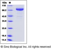 Sino Biological Human Transferrin Receptor / TFRC / CD71 Protein (ECD,
