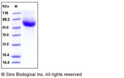 Sino Biological Human IL22BP / IL22RA2 Protein (His Tag) 50ug, Quantity: