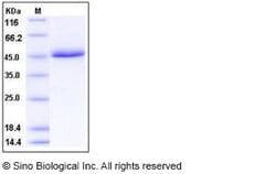 Sino Biological Recombinant Human CD5 Protein (ECD, His Tag), HPLC-verified,