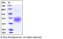Sino Biological Human CD7 Protein (His Tag) 100ug, Quantity: Each of 1
