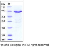 Sino Biological Human PHKG1 Protein (GST Tag) 50ug, Quantity: Each of 1