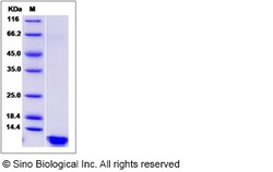 Sino Biological Human INS Protein, Quantity: Each of 1