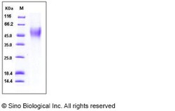Sino Biological Human CD16b / FCGR3B Protein (His Tag, NA2 allotype) 100ug,