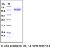 Sino Biological Influenza A H5N1 (A/Anhui/1/2005) Hemagglutinin / HA Protein