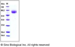 Sino Biological Influenza A H5N1 (A/Anhui/1/2005) Hemagglutinin Protein