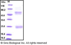 Sino Biological Influenza A H5N1 (A/Anhui/1/2005) Hemagglutinin / HA Protein