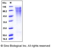 Sino Biological Human KIM-1 / TIM1 / HACVR1 Protein (ECD, His Tag) 100ug,