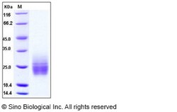 Sino Biological Recombinant Human TIM-1/HAVCR1 Protein (aa 1-135, His Tag),