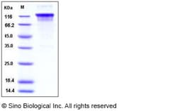 Sino Biological Recombinant Human TIM-1/HAVCR1 Protein (hFc & His Tag),