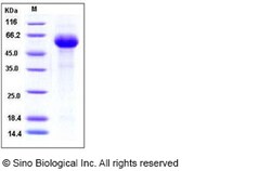 Sino Biological Influenza B (B/Florida/4/2006) Hemagglutinin Protein (HA2