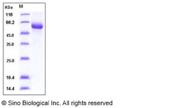 Sino Biological Influenza B (B/Florida/4/2006) Hemagglutinin Protein (HA2