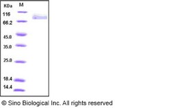 Sino Biological Influenza B (B/Florida/4/2006) Hemagglutinin / HA Protein