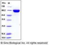 Sino Biological Influenza A H1N1 (A/California/04/2009) Hemagglutinin /