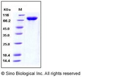 Sino Biological Influenza A H1N1 (A/California/04/2009) Hemagglutinin /