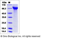 Sino Biological Influenza A H1N1 (A/California/04/2009) Hemagglutinin /