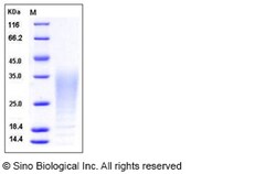 Sino Biological Recombinant Cynomolgus IL-13 Protein (His Tag), Quantity: