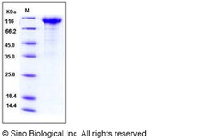 Sino Biological Influenza A H1N1 (A/California/04/2009) Neuraminidase /