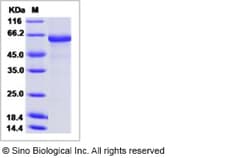 Sino Biological Influenza A H5N1 (A/Indonesia/5/2005) Hemagglutinin / HA-specific