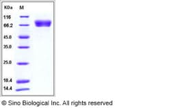 Sino Biological Influenza A H5N1 (A/Indonesia/5/2005) Hemagglutinin / HA