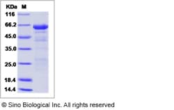 Sino Biological Influenza A H5N1 (A/turkey/Turkey/1/2005) Hemagglutinin