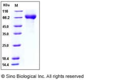 Sino Biological Influenza A H5N1 (A/turkey/Turkey/1/2005) Hemagglutinin