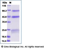 Sino Biological Influenza A H5N1 (A/Vietnam/1194/2004) Hemagglutinin /