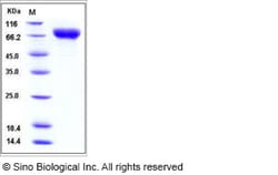 Sino Biological Influenza A H5N1 (A/Vietnam/1194/2004) Hemagglutinin /