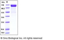 Sino Biological Recombinant Human LIMPII/SR-B2 Protein (His & hFc Tag),
