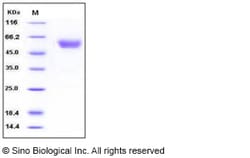 Sino Biological Recombinant Human Podoplanin Protein (ECD, His & hFc Tag),