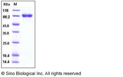 Sino Biological Influenza A H1N1 (A/Brevig Mission/1/1918) Hemagglutinin