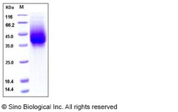 Sino Biological Human respiratory syncytial virus (RSV) (A, rsb1734) glycoprotein