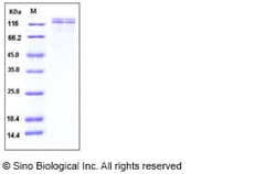Sino Biological Recombinant Human VLDL Receptor/VLDLR Protein (His Tag),
