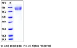 Sino Biological Recombinant Human CEACAM-5/CD66e Protein (His Tag), HPLC-verified,