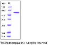 Sino Biological Human Glucokinase / GCK Protein 50ug, Quantity: Each of
