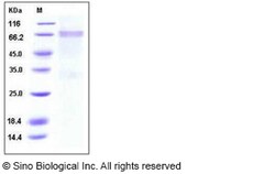 Sino Biological Influenza A H7N7 (A/Netherlands/219/2003) Hemagglutinin