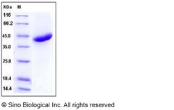 Sino Biological Human R-Spondin 1 / RSPO1 Protein (His Tag) 100ug, Quantity: