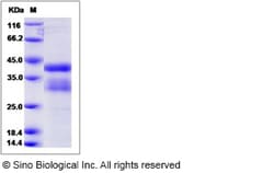 Sino Biological Human R-Spondin 1 / RSPO1 Protein 1mg, Quantity: Each of