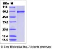 Sino Biological Influenza A H1N1 (A/California/07/2009) Hemagglutinin /
