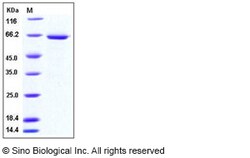 Sino Biological Human SMPD1 Protein (His Tag) 50ug, Quantity: Each of 1
