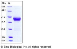 Sino Biological Recombinant Rhesus DKK-1 Protein (256 Asn/Gln, His Tag),