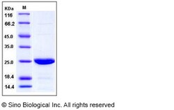 Sino Biological Human cIAP1 / HIAP2 Protein (AVI Tag) 100ug, Quantity:
