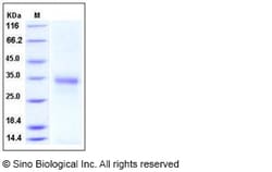 Sino Biological Human CD74 Protein (ECD, His Tag) 100ug, Quantity: Each