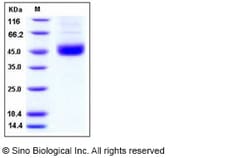 Sino Biological Human SMYD2 / KMT3C Protein (His Tag) 50ug, Quantity: Each