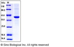 Sino Biological Recombinant Human ABHD4 Protein (His Tag), Quantity: Each