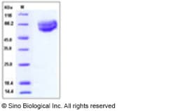 Sino Biological Recombinant Human IL-18Rα Protein (ECD, His Tag), HPLC-verified,