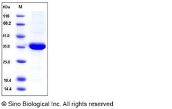 Sino Biological Human ACBD6 Protein (His Tag) 100ug, Quantity: Each of